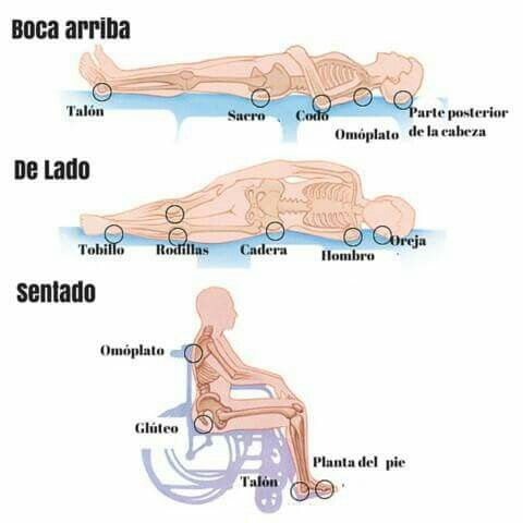 donde salen las llagas